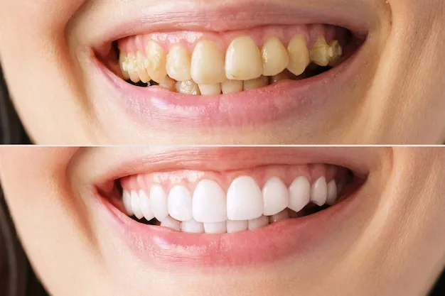 Sonrisa, ¿Linda o Espantosa?